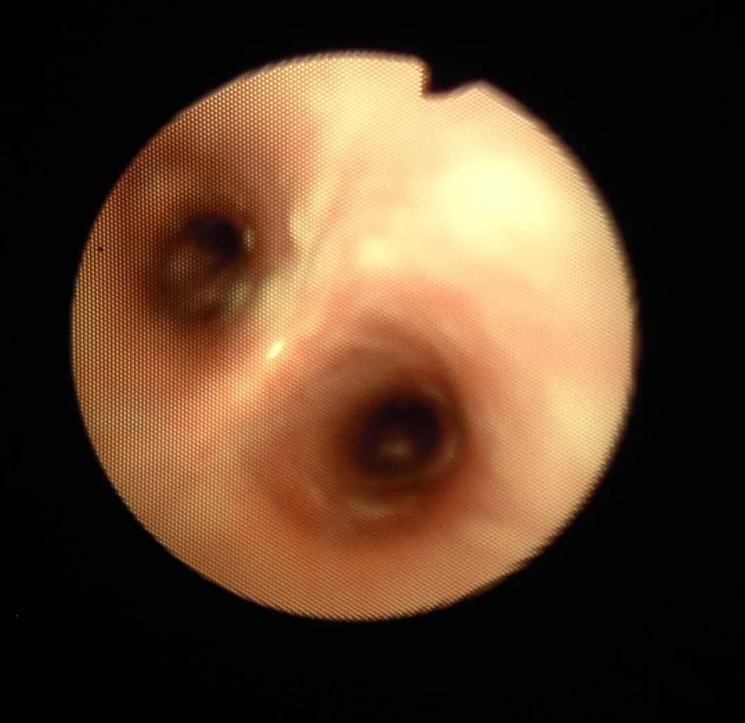 COPD u koni: objawy, leczenie i profilaktyka RAO w hodowli